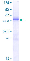 HN1 / ARM2 Protein - 12.5% SDS-PAGE of human HN1 stained with Coomassie Blue