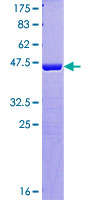 HN1L Protein - 12.5% SDS-PAGE of human C16orf34 stained with Coomassie Blue