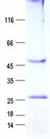 HNE / Neutrophil Elastase Protein