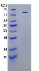 HNE / Neutrophil Elastase Protein - Recombinant Elastase 2, Neutrophil By SDS-PAGE