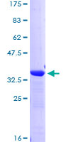 HNF1B / HNF1 Beta Protein - 12.5% SDS-PAGE Stained with Coomassie Blue.