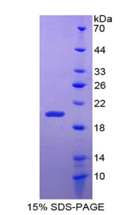 HNF1B / HNF1 Beta Protein - Recombinant Hepatocyte Nuclear Factor 1 Beta By SDS-PAGE
