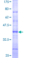 HNF4A / HNF4 Protein - 12.5% SDS-PAGE Stained with Coomassie Blue.