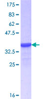 HNF4G / HNF4 Gamma Protein - 12.5% SDS-PAGE Stained with Coomassie Blue.