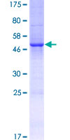 HNLF / TMED4 Protein - 12.5% SDS-PAGE of human TMED4 stained with Coomassie Blue