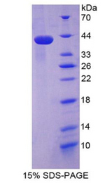 HNP-4 / DEFA4 Protein