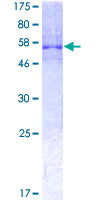 HnRNP A0 Protein - 12.5% SDS-PAGE of human HNRNPA0 stained with Coomassie Blue