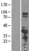 HnRNP-E1 / PCBP1 Protein - Western validation with an anti-DDK antibody * L: Control HEK293 lysate R: Over-expression lysate