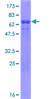 HnRNP-E1 / PCBP1 Protein - 12.5% SDS-PAGE of human PCBP1 stained with Coomassie Blue