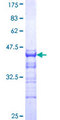 HnRNP-E1 / PCBP1 Protein - 12.5% SDS-PAGE Stained with Coomassie Blue.