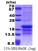 HnRNP-E1 / PCBP1 Protein