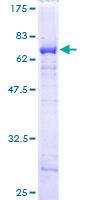HNRNP-E2 / PCBP2 Protein - 12.5% SDS-PAGE of human PCBP2 stained with Coomassie Blue