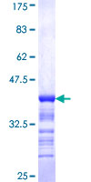 HNRNP-E2 / PCBP2 Protein - 12.5% SDS-PAGE Stained with Coomassie Blue.