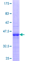 HnRNP U Protein - 12.5% SDS-PAGE Stained with Coomassie Blue.