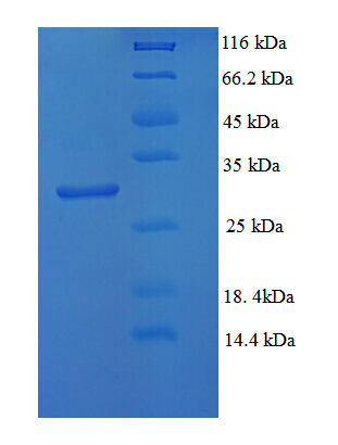 HNRNPA2B1 Protein