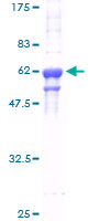 HNRNPA2B1 Protein - 12.5% SDS-PAGE of human HNRPA2B1 stained with Coomassie Blue