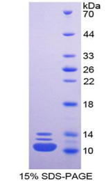 HNRNPA2B1 Protein - Recombinant Heterogeneous Nuclear Ribonucleoprotein A2/B1 By SDS-PAGE