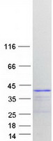 HNRNPA2B1 Protein - Purified recombinant protein HNRNPA2B1 was analyzed by SDS-PAGE gel and Coomassie Blue Staining