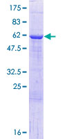 HNRNPAB Protein - 12.5% SDS-PAGE of human HNRPAB stained with Coomassie Blue