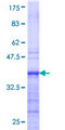 HNRNPAB Protein - 12.5% SDS-PAGE Stained with Coomassie Blue.