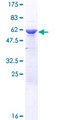 HNRNPC / HNRNP C Protein - 12.5% SDS-PAGE of human HNRNPC stained with Coomassie Blue