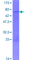 HNRNPD / AUF1 Protein - 12.5% SDS-PAGE of human HNRPD stained with Coomassie Blue