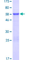 HNRNPH3 / hnRNP H3 Protein - 12.5% SDS-PAGE of human HNRNPH3 stained with Coomassie Blue