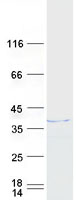 HNRNPH3 / hnRNP H3 Protein - Purified recombinant protein HNRNPH3 was analyzed by SDS-PAGE gel and Coomassie Blue Staining