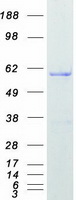 HNRNPK / hnRNP K Protein - Purified recombinant protein HNRNPK was analyzed by SDS-PAGE gel and Coomassie Blue Staining