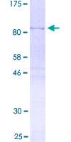 HNRNPL / hnRNP L Protein - 12.5% SDS-PAGE of human HNRNPL stained with Coomassie Blue