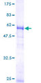 HNRPA1 / HnRNP A1 Protein - 12.5% SDS-PAGE of human HNRPA1 stained with Coomassie Blue