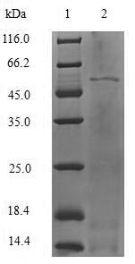 HNRPM / HNRNPM Protein - (Tris-Glycine gel) Discontinuous SDS-PAGE (reduced) with 5% enrichment gel and 15% separation gel.