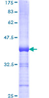 HNRPM / HNRNPM Protein - 12.5% SDS-PAGE Stained with Coomassie Blue.