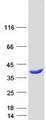 HOGA1 Protein - Purified recombinant protein HOGA1 was analyzed by SDS-PAGE gel and Coomassie Blue Staining