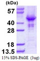 HOMER2 / Homer 2 Protein