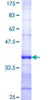 HOOK1 Protein - 12.5% SDS-PAGE Stained with Coomassie Blue.
