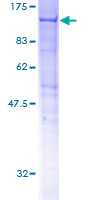 HOOK2 Protein - 12.5% SDS-PAGE of human HOOK2 stained with Coomassie Blue