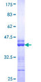HOOK2 Protein - 12.5% SDS-PAGE Stained with Coomassie Blue.