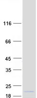 HOPX / HOP Protein - Purified recombinant protein HOPX was analyzed by SDS-PAGE gel and Coomassie Blue Staining