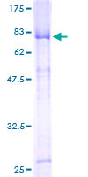 HORMAD1 Protein - 12.5% SDS-PAGE of human HORMAD1 stained with Coomassie Blue