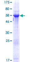 HORMAD2 Protein - 12.5% SDS-PAGE of human HORMAD2 stained with Coomassie Blue