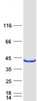 HORMAD2 Protein - Purified recombinant protein HORMAD2 was analyzed by SDS-PAGE gel and Coomassie Blue Staining