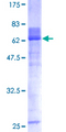 HOXA1 Protein - 12.5% SDS-PAGE of human HOXA1 stained with Coomassie Blue