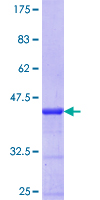 HOXA1 Protein - 12.5% SDS-PAGE Stained with Coomassie Blue.