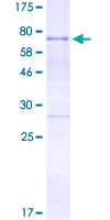 HOXA10 Protein - 12.5% SDS-PAGE of human HOXA10 stained with Coomassie Blue