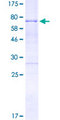 HOXA10 Protein - 12.5% SDS-PAGE of human HOXA10 stained with Coomassie Blue
