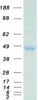 HOXA10 Protein - Purified recombinant protein HOXA10 was analyzed by SDS-PAGE gel and Coomassie Blue Staining
