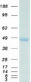 HOXA10 Protein - Purified recombinant protein HOXA10 was analyzed by SDS-PAGE gel and Coomassie Blue Staining