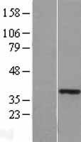 HOXA11 Protein - Western validation with an anti-DDK antibody * L: Control HEK293 lysate R: Over-expression lysate