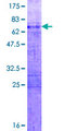 HOXA11 Protein - 12.5% SDS-PAGE of human HOXA11 stained with Coomassie Blue